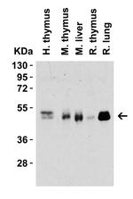 CD4 Antibody in Western Blot (WB)