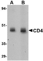 CD4 Antibody in Western Blot (WB)