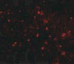 ORAI1 Antibody in Immunohistochemistry (IHC)