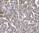 ORAI1 Antibody in Immunohistochemistry (IHC)