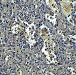 ORAI1 Antibody in Immunohistochemistry (IHC)