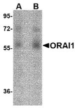 ORAI1 Antibody in Western Blot (WB)