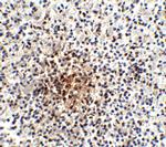 PD-1 Antibody in Immunohistochemistry (IHC)