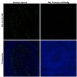 PD-1 Antibody in Immunohistochemistry (Paraffin) (IHC (P))