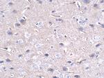PD-1 Antibody in Immunohistochemistry (Paraffin) (IHC (P))