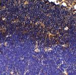 PD-1 Antibody in Immunohistochemistry (Paraffin) (IHC (P))