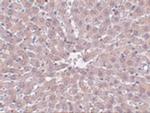 IRAK1 Monoclonal Antibody (8F1A7)