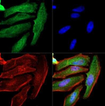 Cytokeratin 1 Monoclonal Antibody (LHK1)