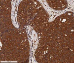 Cytokeratin 1 Antibody in Immunohistochemistry (Paraffin) (IHC (P))