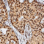 TERT Antibody in Immunohistochemistry (Paraffin) (IHC (P))