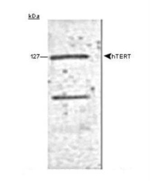 TERT Antibody in Western Blot (WB)