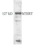 TERT Antibody in Western Blot (WB)