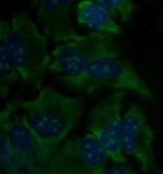 rRNA Antibody in Immunocytochemistry (ICC/IF)