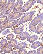 MRP1 Antibody in Immunohistochemistry (Paraffin) (IHC (P))