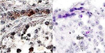 MRP1 Antibody in Immunohistochemistry (Paraffin) (IHC (P))