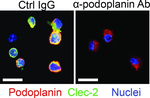 Podoplanin Antibody in Immunocytochemistry (ICC/IF)