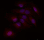 Blimp-1 Antibody in Immunocytochemistry (ICC/IF)