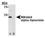 Nitrated-alpha Synuclein (Tyr125, Tyr133) Antibody in Western Blot (WB)