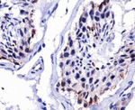 DUX4 Antibody in Immunohistochemistry (Paraffin) (IHC (P))
