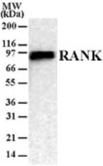 RANK Monoclonal Antibody (9A725)