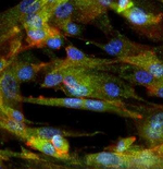 IKK beta Monoclonal Antibody (10AG2)