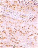 IKK beta Antibody in Immunohistochemistry (Paraffin) (IHC (P))