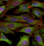 IKK alpha Monoclonal Antibody (14A231)