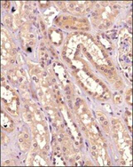 IKK alpha Antibody in Immunohistochemistry (Paraffin) (IHC (P))
