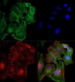 TBK1 Antibody in Immunocytochemistry (ICC/IF)
