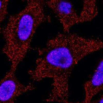 p73 Monoclonal Antibody (5B429)