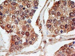 p73 Antibody in Immunohistochemistry (Paraffin) (IHC (P))