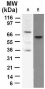 p73 Antibody in Western Blot (WB)