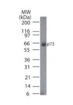 p73 Antibody in Western Blot (WB)
