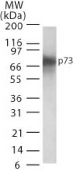 p73 Antibody in Western Blot (WB)