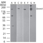 DNMT1 Antibody in Western Blot (WB)