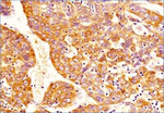DNMT3A Antibody in Immunohistochemistry (Paraffin) (IHC (P))