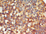 TLR6 Antibody in Immunohistochemistry (Paraffin) (IHC (P))