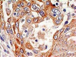 p73 delta Antibody in Immunohistochemistry (Paraffin) (IHC (P))