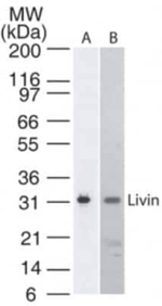 Livin Monoclonal Antibody (88C570)