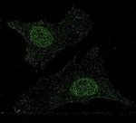 MiTF Monoclonal Antibody (21D1418)