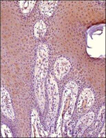 MiTF Antibody in Immunohistochemistry (Paraffin) (IHC (P))