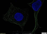 TLR4 Monoclonal Antibody (76B357.1)