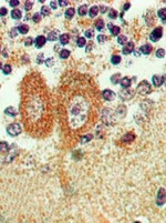 Bi-1 Antibody in Immunohistochemistry (Paraffin) (IHC (P))