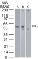 ROR gamma Monoclonal Antibody (4G419)
