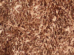 IL-17F Antibody in Immunohistochemistry (Paraffin) (IHC (P))
