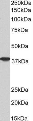 AIM2 Antibody in Western Blot (WB)