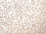 HMGB1 Antibody in Immunohistochemistry (Paraffin) (IHC (P))