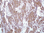 HMGB1 Antibody in Immunohistochemistry (Paraffin) (IHC (P))