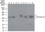 Podoplanin Antibody in Western Blot (WB)