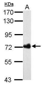 Helicobacter pylori Urease B Monoclonal Antibody (GT962)